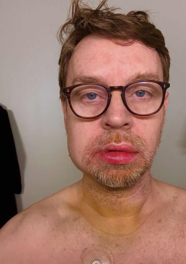 Darren Hayes has revealed he nearly died following a life-changing accident at his home.