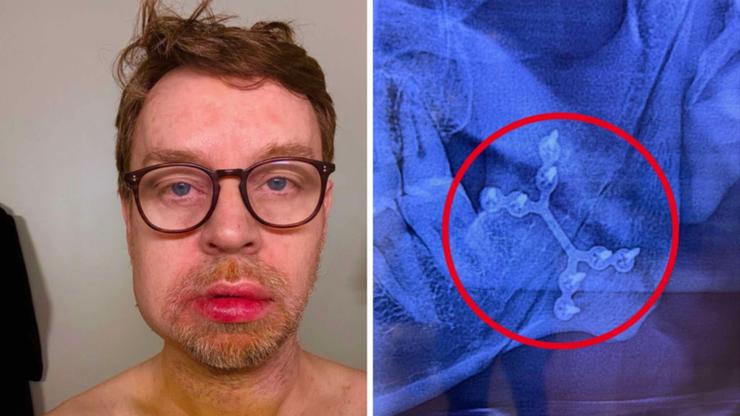 Aussie Musician Darren Hayes reveals he ‘nearly died’ after suffering life-changing accident at home 