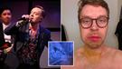 Darren Hayes says he nearly died after suffering a “terrible accident”.