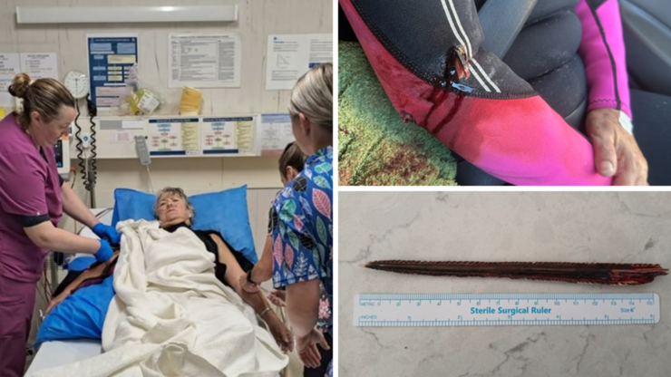 Pam Bennett narrowly escaped death after being attacked by a stingray while snorkelling.
