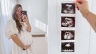 Influencer Caitlin Bailey has sparked outrage as she travelled to United States for a common procedure banned in Australia.