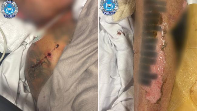 A senior bikie has been shot and suffered burns before being left outside Rockingham Hospital.