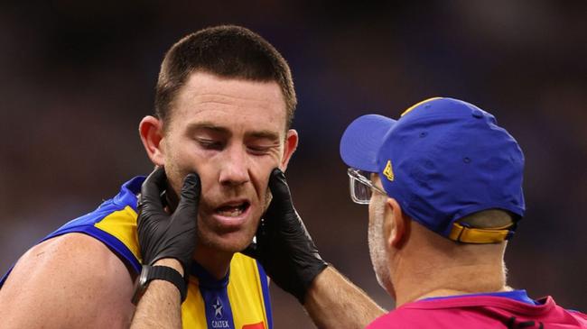 Jeremy McGovern might be forced into AFL retirement. 