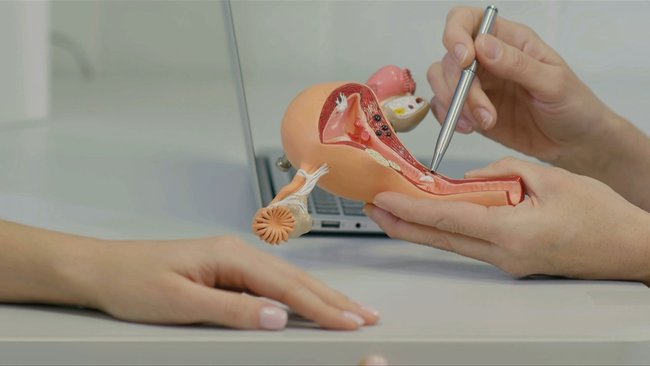 Ovarian cancer kills one Australian woman every eight hours.