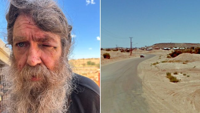 David Harcus, 54, smacked his face on the concrete when he was punched in the head from behind in February.